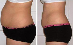 Starbucks green tea help lose weight picture 2